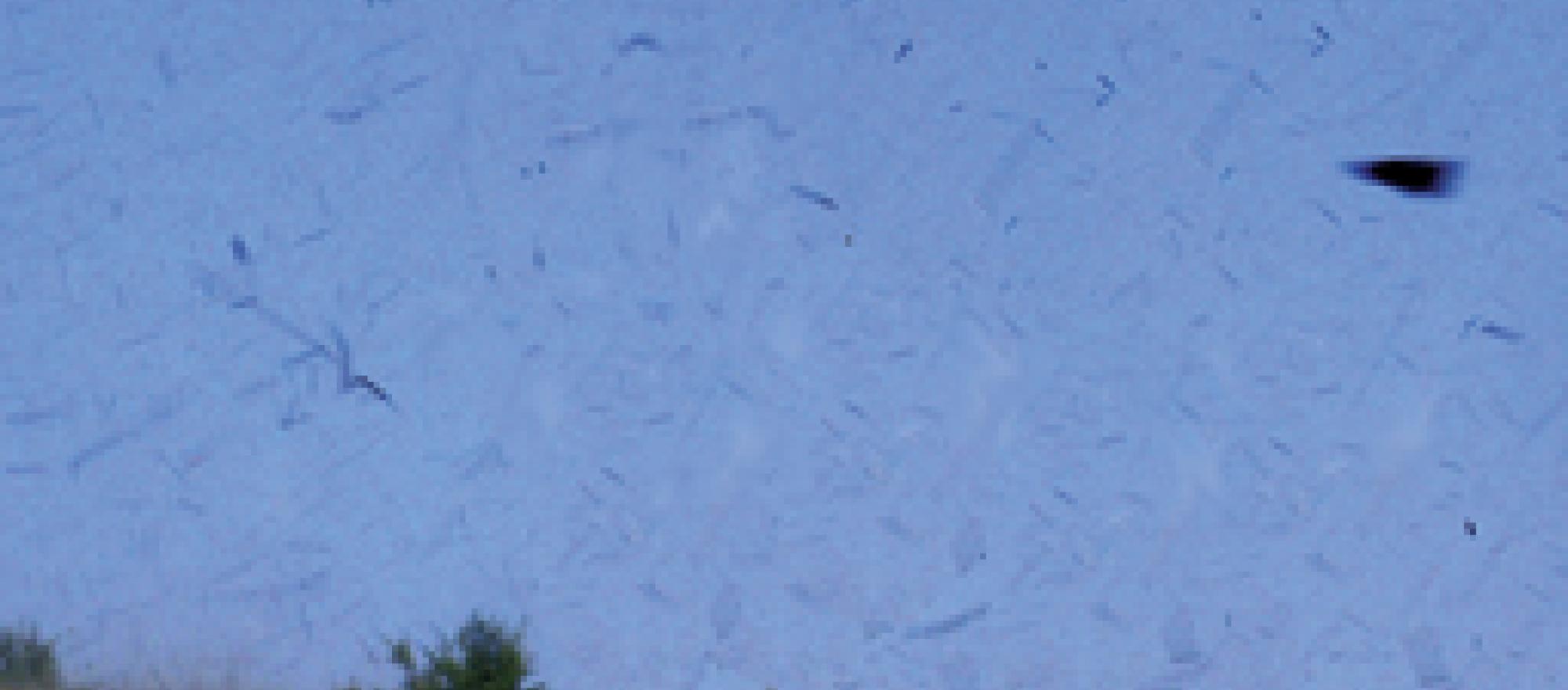 The new Thunderpack lets you take off like James Bond.